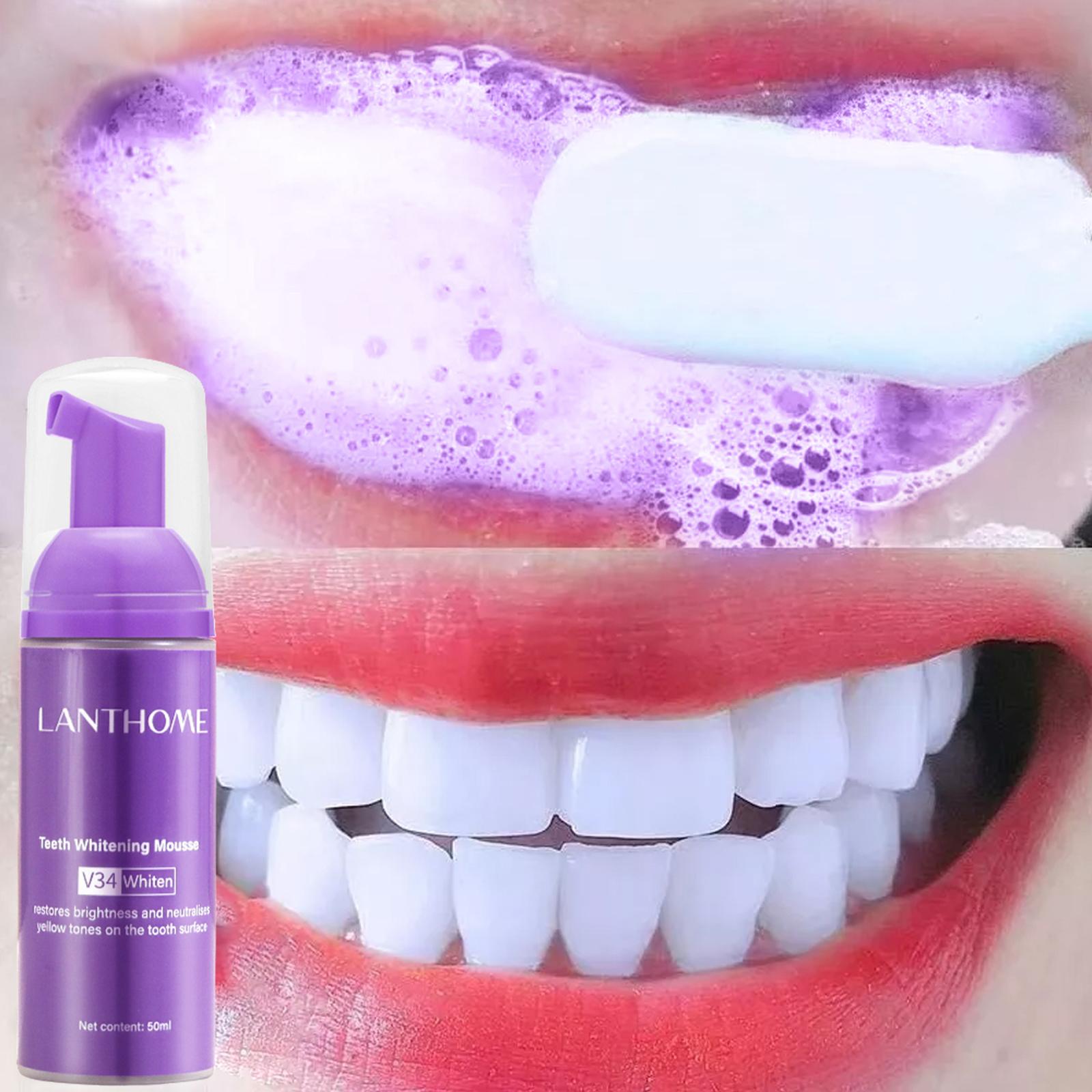 Teeth Whitening Best - V34 Mousse Teeth Cleaning Toothpaste Effective