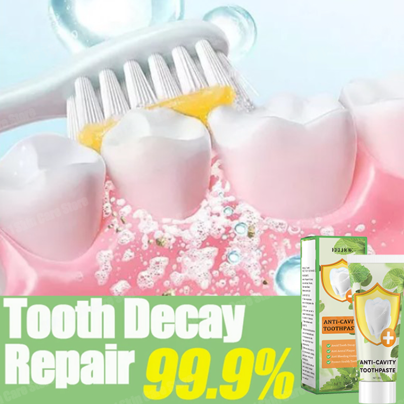 Teeth Whitening Best - Anti Decay Toothpaste repairs cavities, removes
