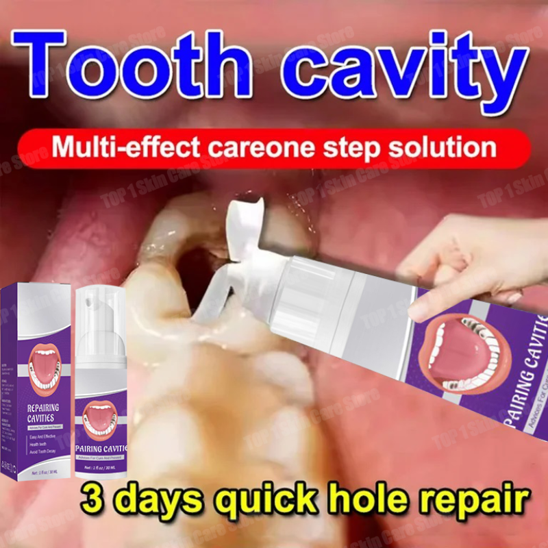 Teeth Whitening Best - Hot sales Best-selling, Scientific Repairs Cavities,