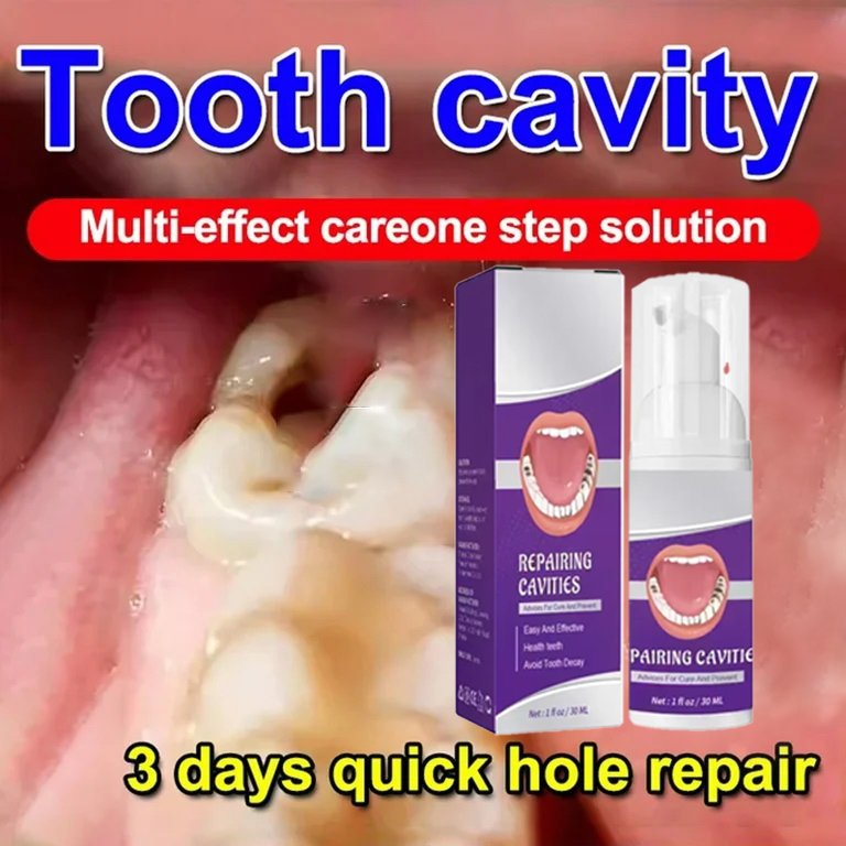 Teeth Whitening Best - Teeth Cleaning Toothpaste Removes Tooth Stains