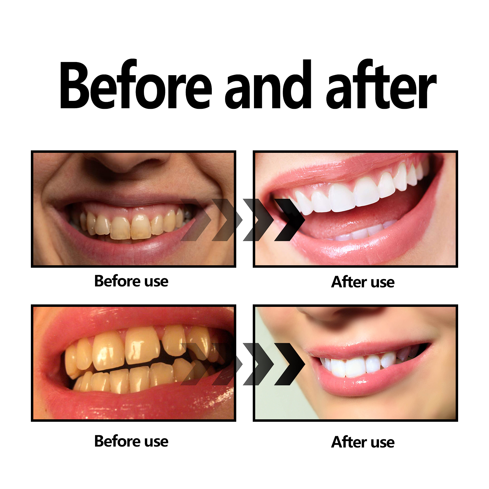 Activated Coconut Charcoal Too - Teeth Whitening Charcoal review and price