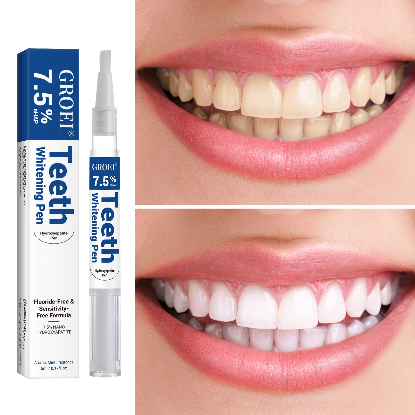 Hydroxyapatite Tooth Whitening - Teeth Whitening Pen review and price