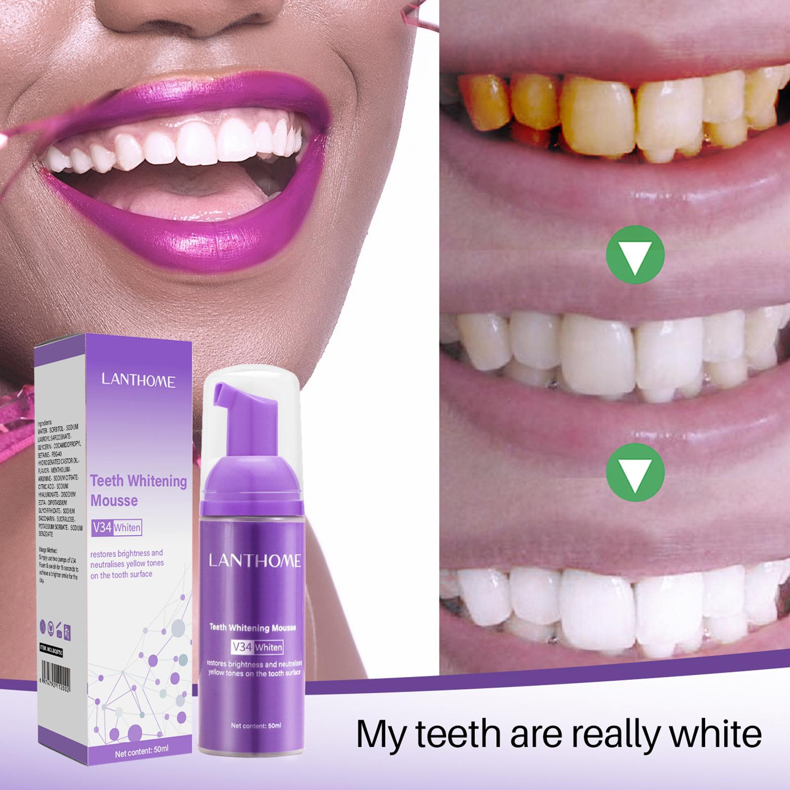 V34 Mousse Teeth Cleaning Toot - Teeth Whitening Best review and price
