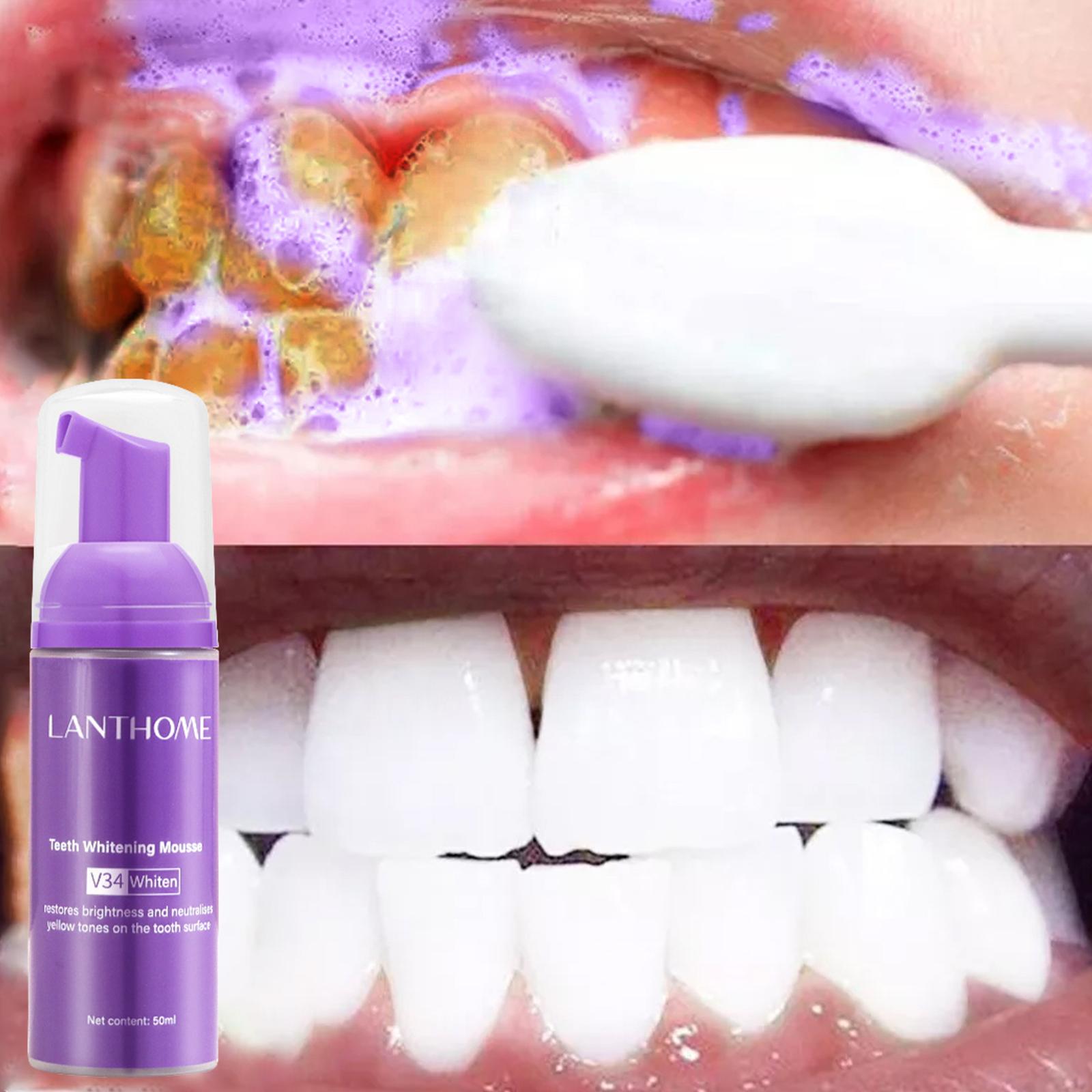 V34 Mousse Teeth Cleaning Toot - Teeth Whitening Best review and price