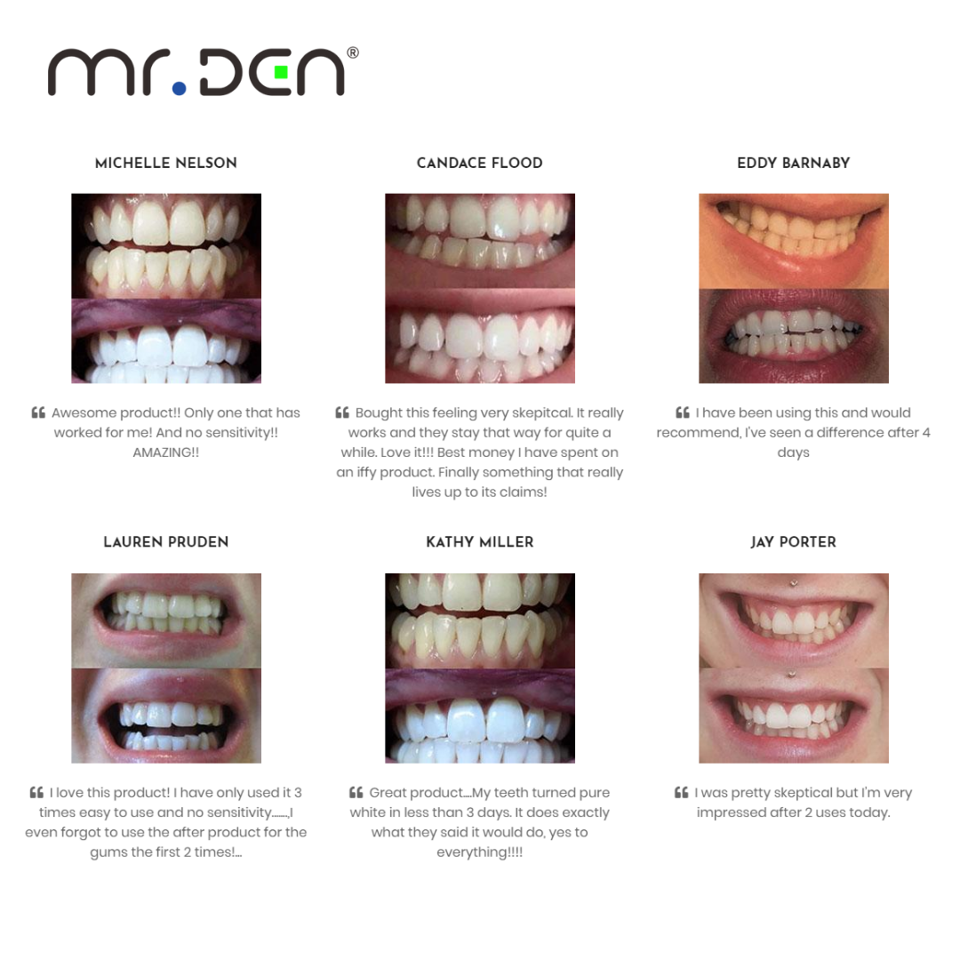 Dr. Whiten 3 Pack Teeth Whiten - Teeth Whitening Gum review and price