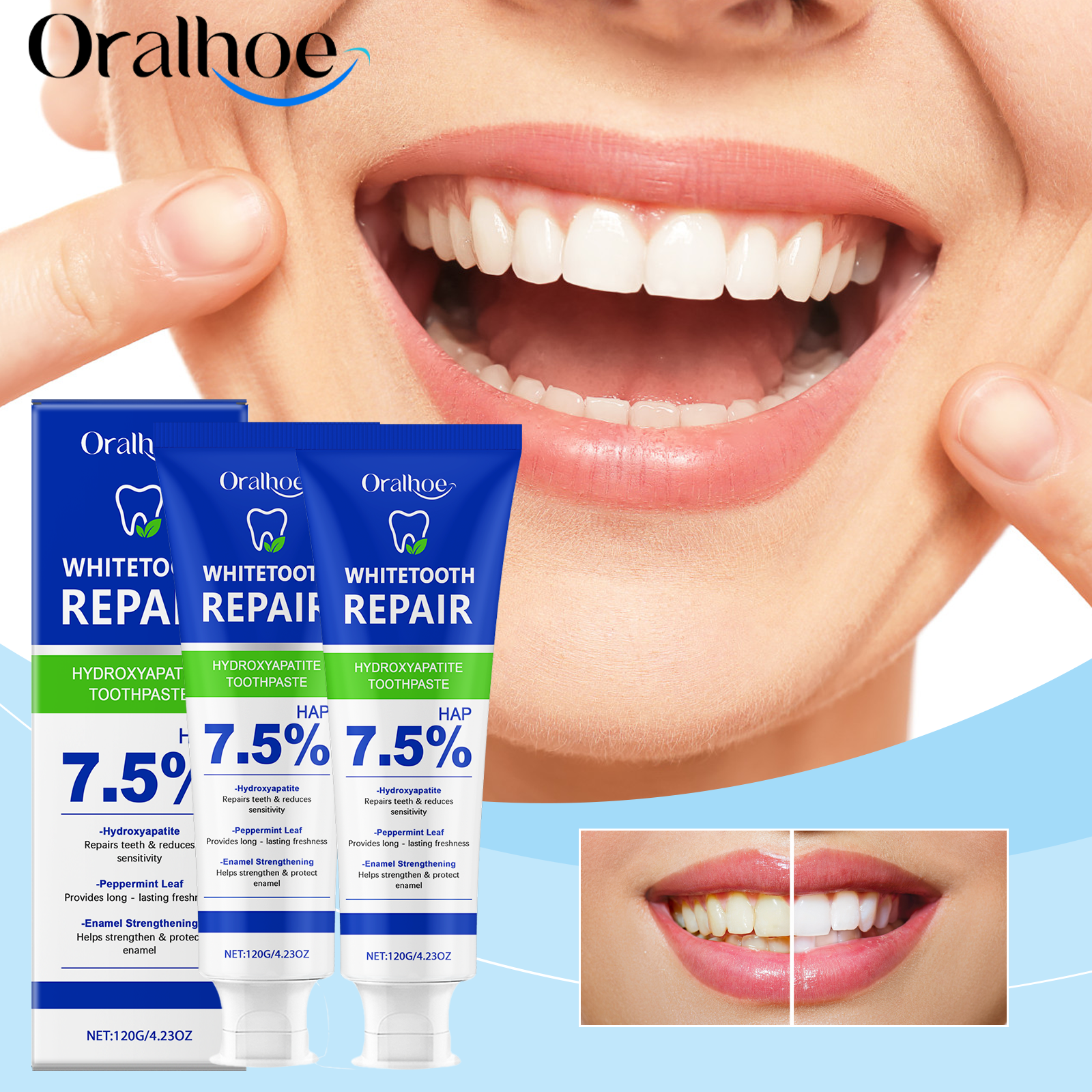 Oralhoe Nicotinamide Whitening - Teeth Whitening Best review and price
