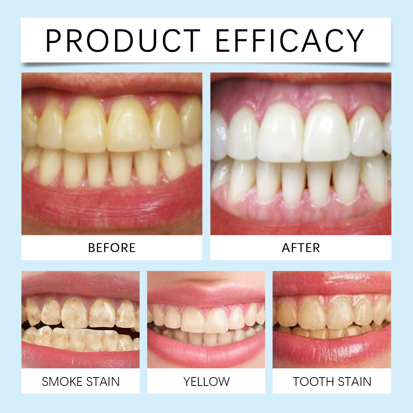 Oralhoe Nicotinamide Whitening - Teeth Whitening Best review and price