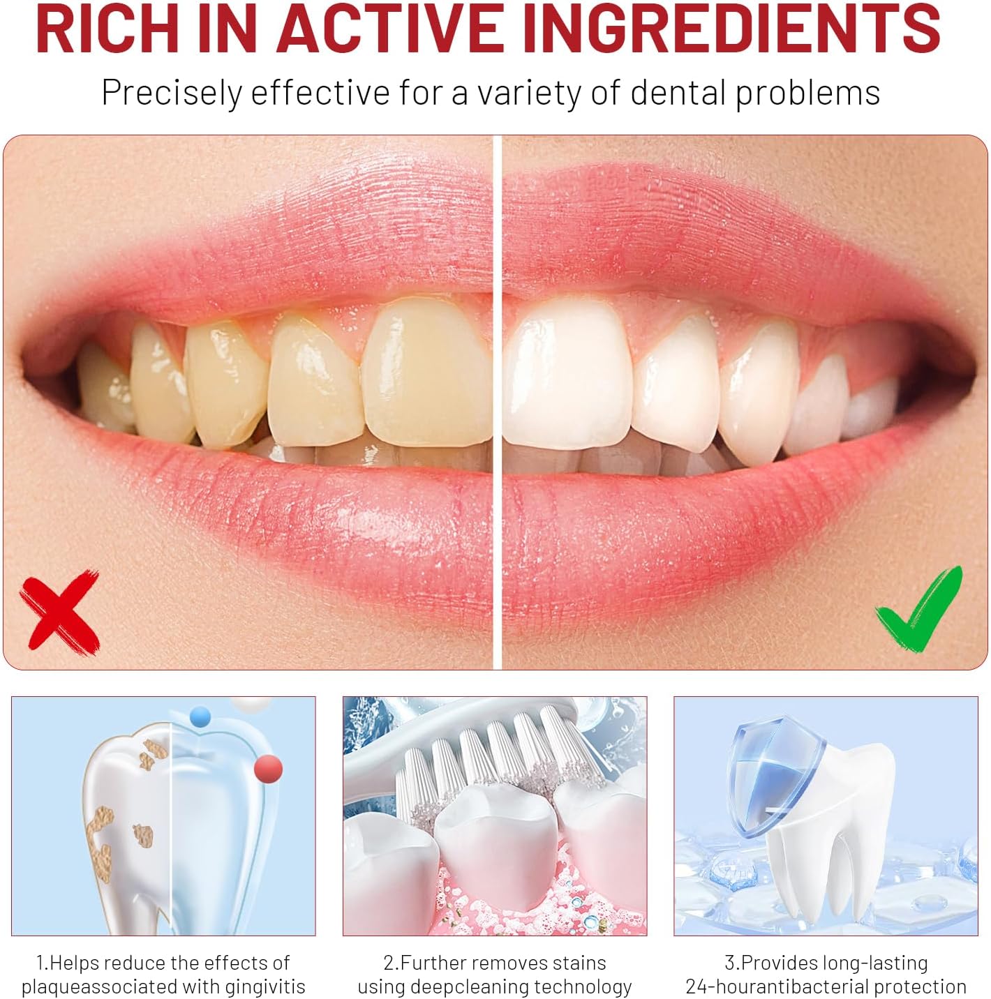 Niacinamide Whitening Toothpas - Teeth Whitening Best review and price