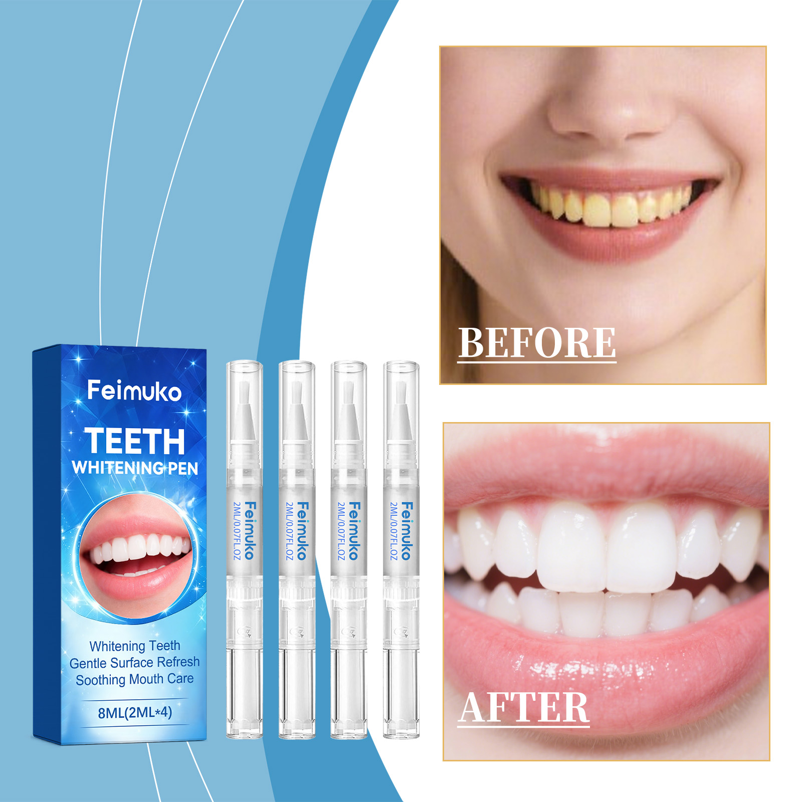 Feimuko 8ml Teeth Gel Pen Gent - Teeth Whitening Pen review and price