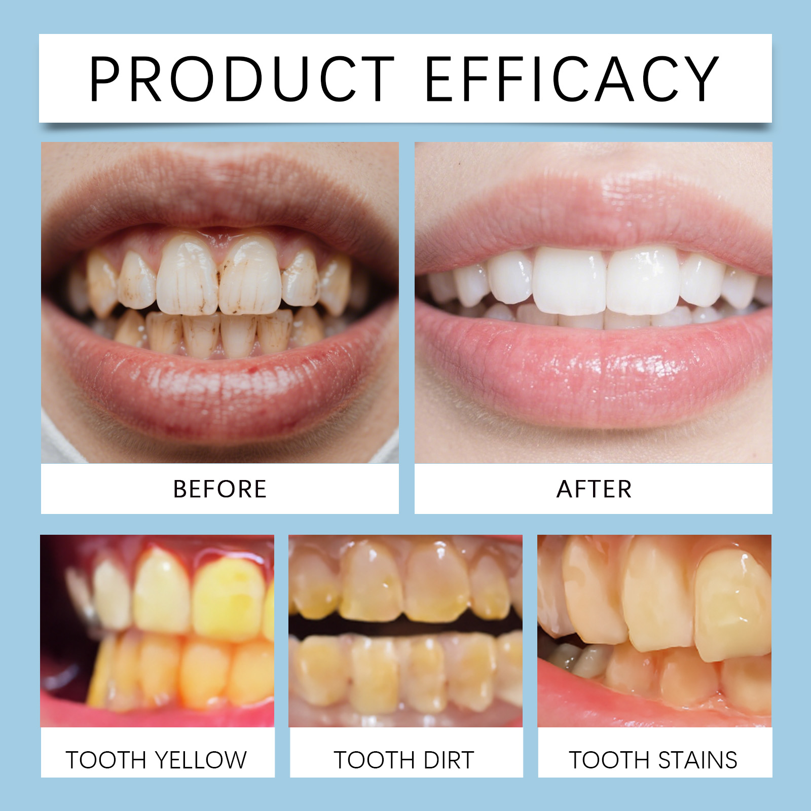 Feimuko 8ml Teeth Gel Pen Gent - Teeth Whitening Pen review and price