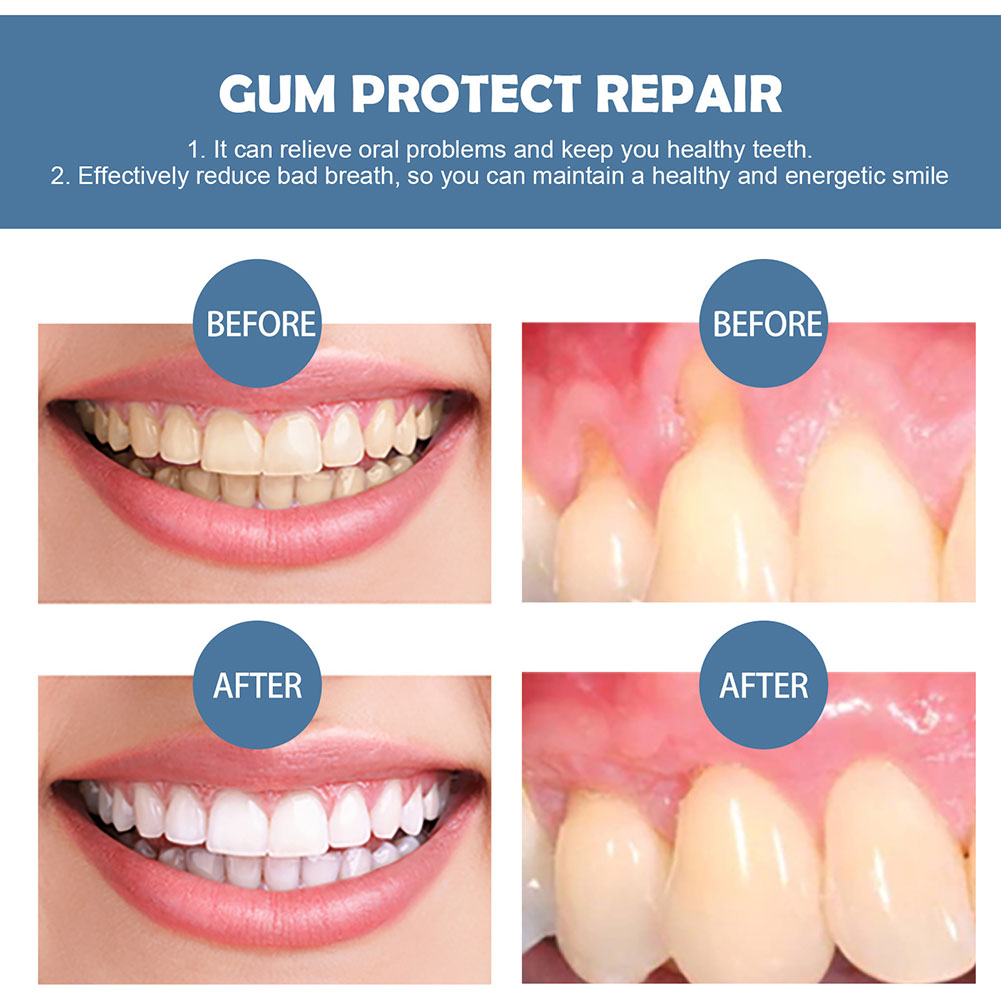 Gum Protection Repair Gel Reli - Teeth Whitening Pen review and price