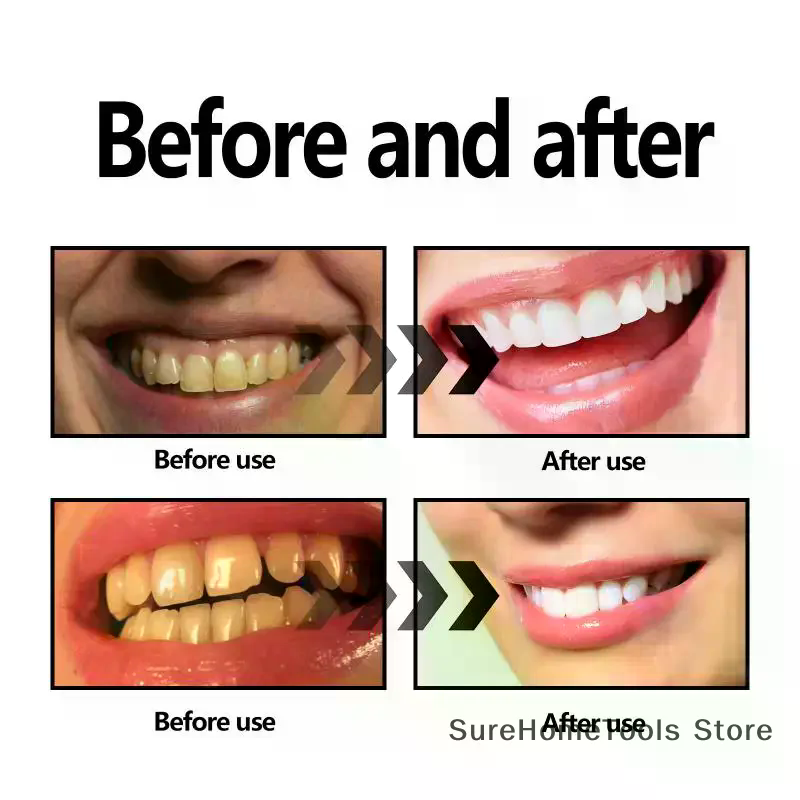 Bamboo Charcoal Powder For Tee - Teeth Whitening Charcoal review and price