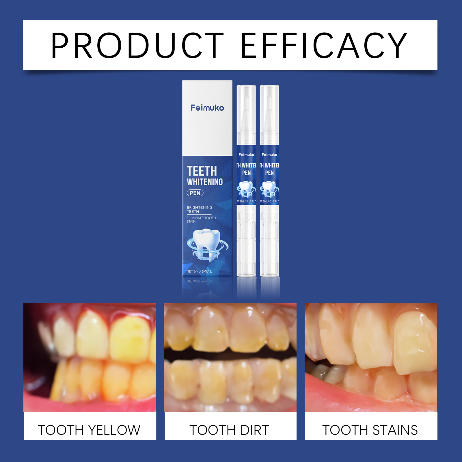 Feimuko Teeth Whitening Pen Ma - Teeth Whitening Pen review and price