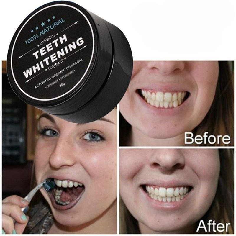 1 Box Activated Charcoal Teeth - Teeth Whitening Charcoal review and price