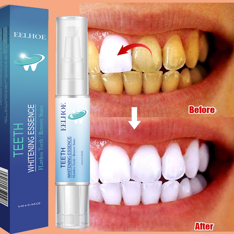 Teeth Whitening Pen Dental Ess - Teeth Whitening Bleaching Kit review and price