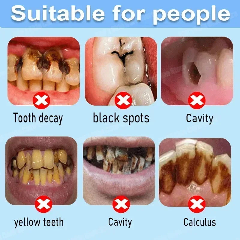 Anti Decay Toothpaste repairs  - Teeth Whitening Best review and price