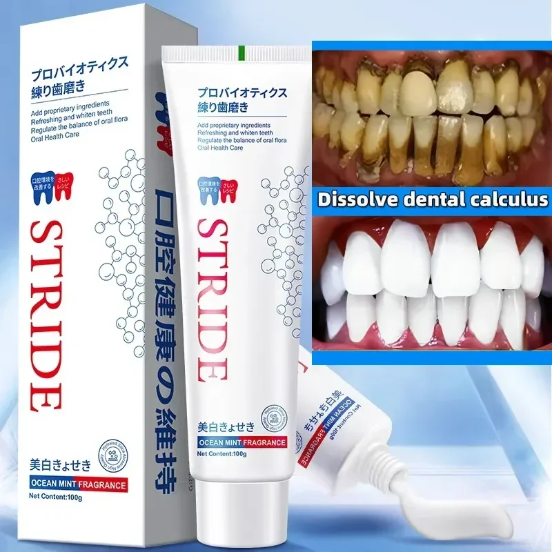 Dental Calculus Remover Remova - Teeth Whitening Best review and price