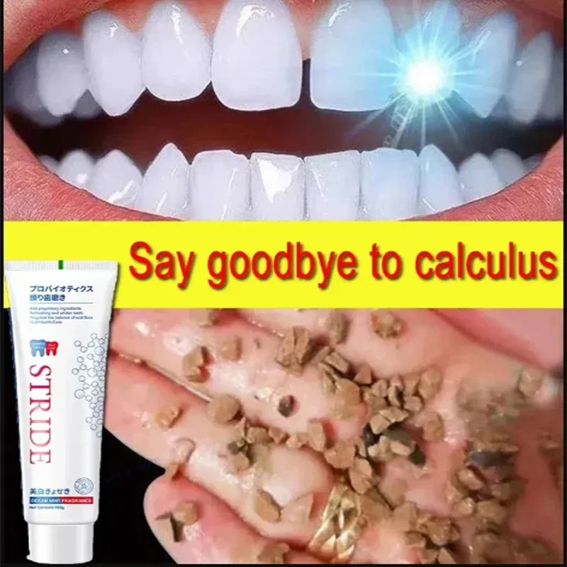 Dental Calculus Remover Remova - Teeth Whitening Best review and price