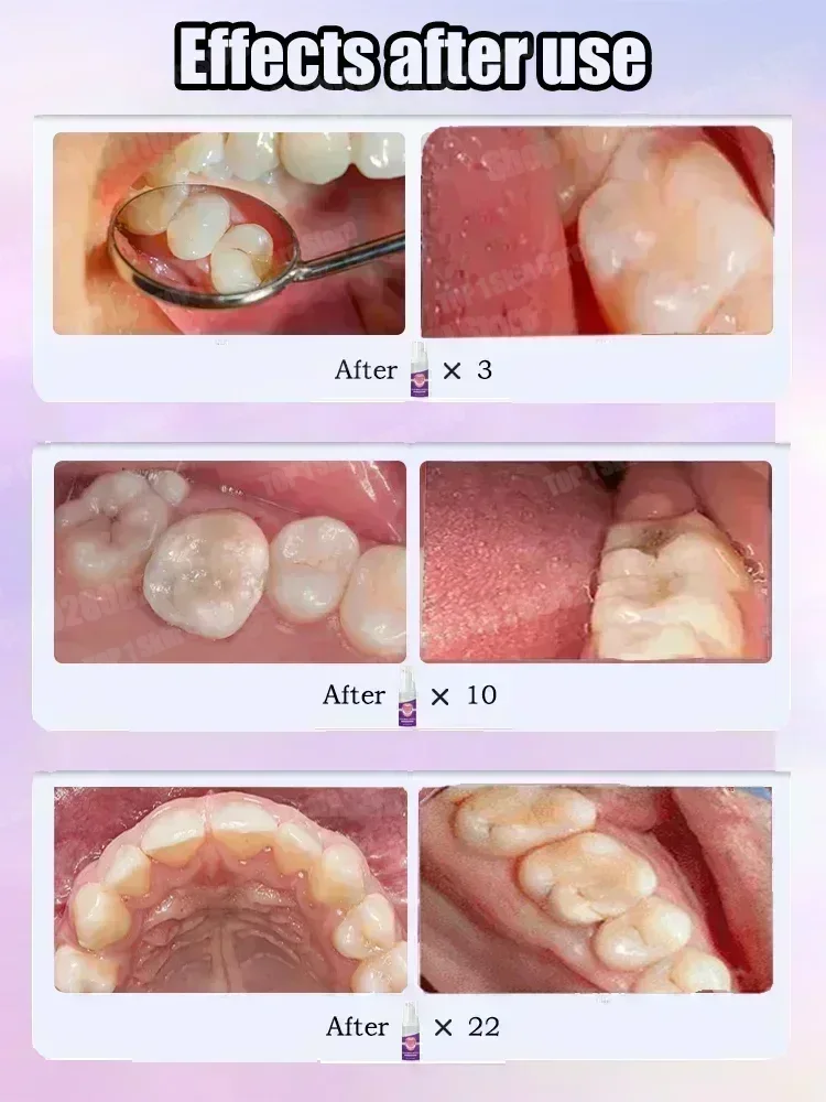 Hot sales Best-selling, Scient - Teeth Whitening Best review and price