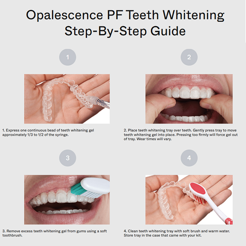 opalescence pf 15% refill kit  - Teeth Whitening Gel Opalescence review and price