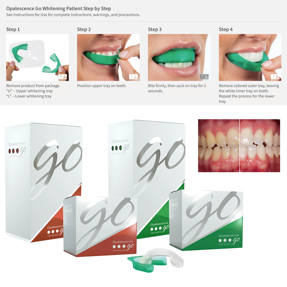 Opalescence Go Teeth Whitening - Teeth Whitening Gel Opalescence review and price