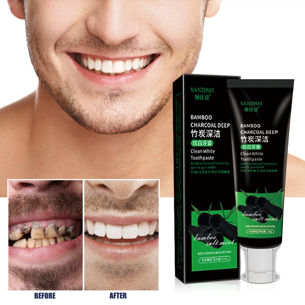 110g Bamboo Charcoal Black Too - Teeth Whitening Charcoal review and price