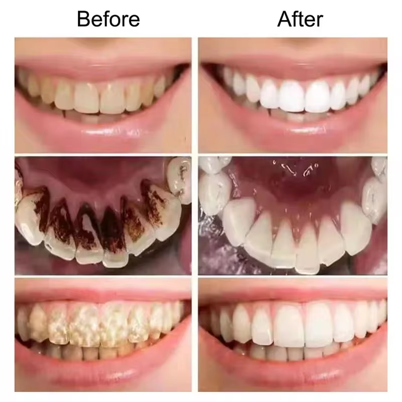 7.5% Hydroxyapatite Probiotic  - Teeth Whitening Best review and price