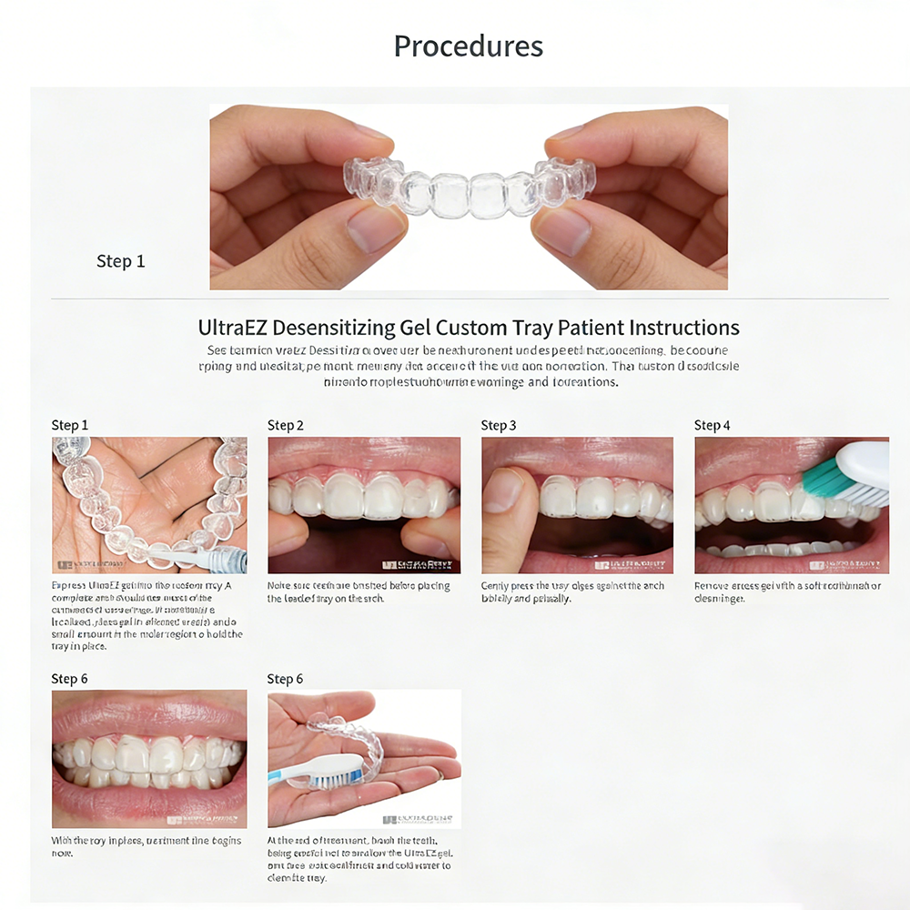 Ultra Ez Dental Desensitizing  - Teeth Whitening Gel Opalescence review and price