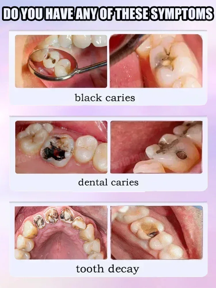 Teeth Cleaning Toothpaste Remo - Teeth Whitening Best review and price