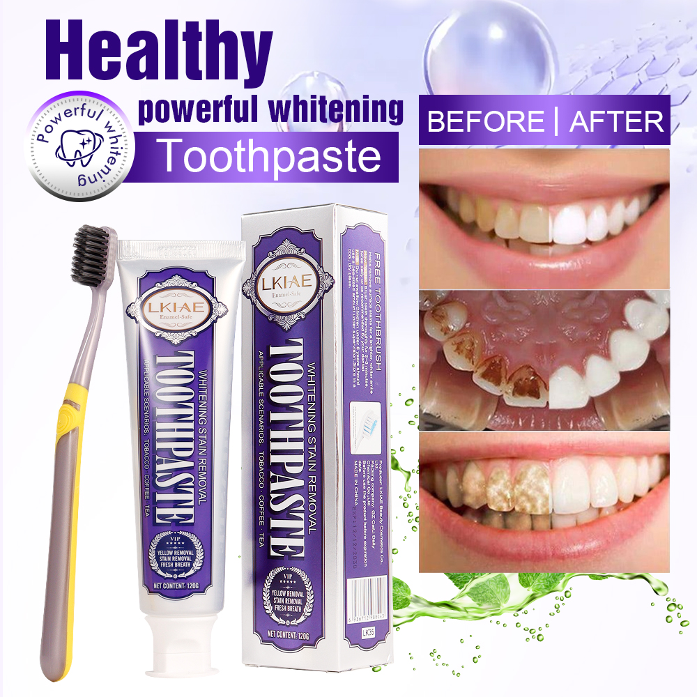 LKIAE White Teeth Whitening To - Teeth Whitening Natural review and price