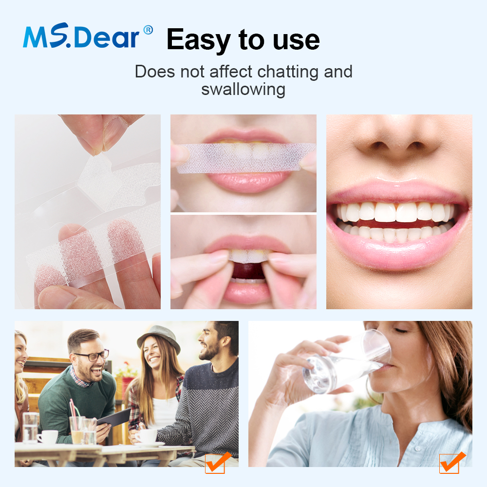 Teeth Whitening Strips Cleansi - Teeth Whitening Near Me review and price